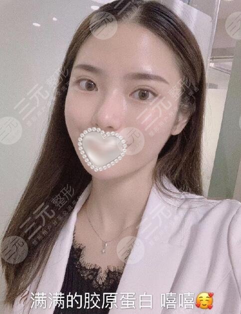 广州南方医院热玛吉果图