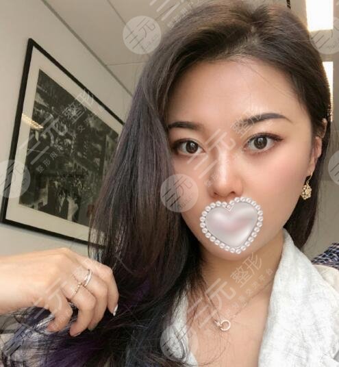 深圳北大医院热玛吉做的怎样