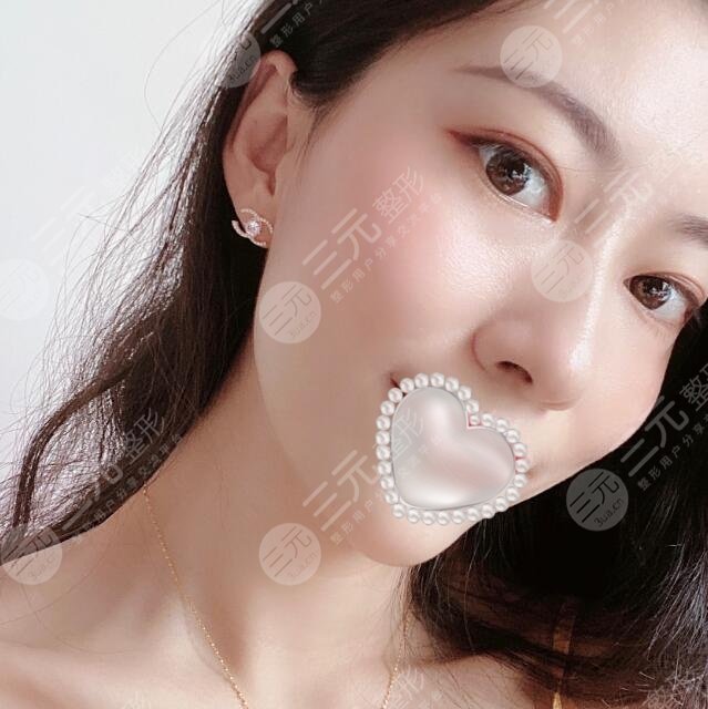 深圳北大医院热玛吉果图