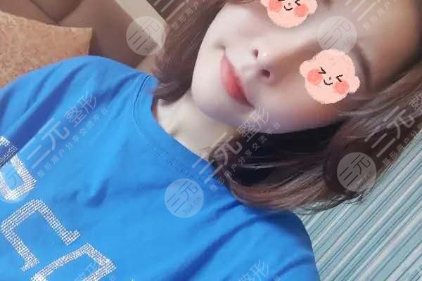 上海九院隆鼻价目表2025大公开，还有漂亮的隆鼻果分享哦！