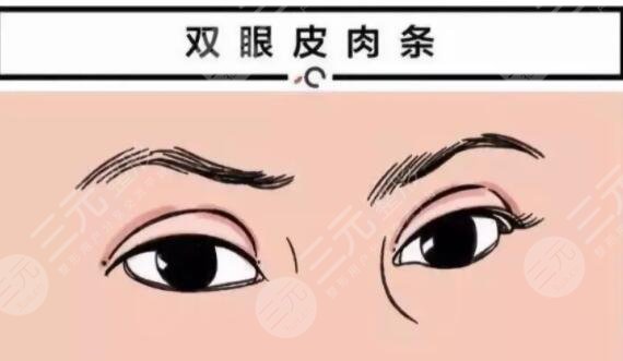 肉条