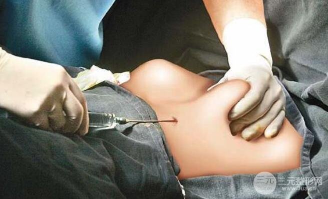 假体的价格真的对手术果有这么大的影响吗?