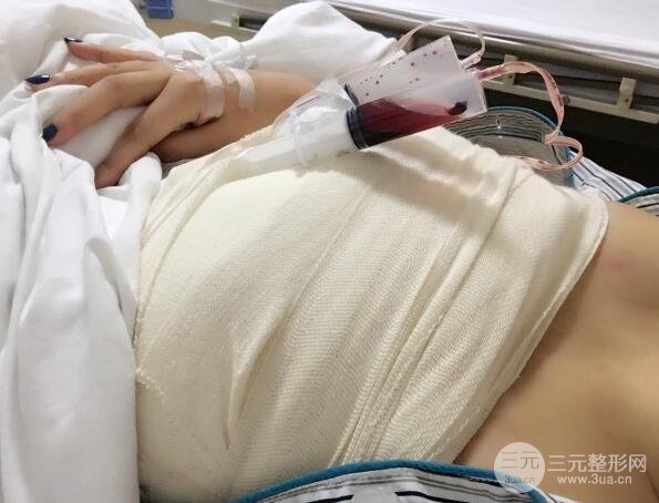 这是我手术后拍的照片