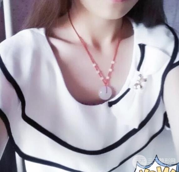 蜜桃假体隆胸真人案例果柔软~