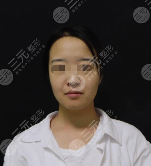 欧洲之星4d真人果前