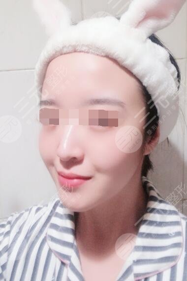 欧洲之星4d真人果后