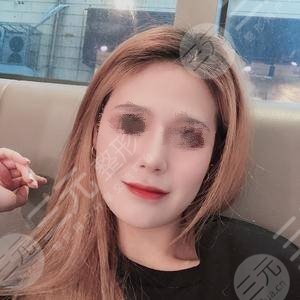 南华大学附属南华医院点痣果图