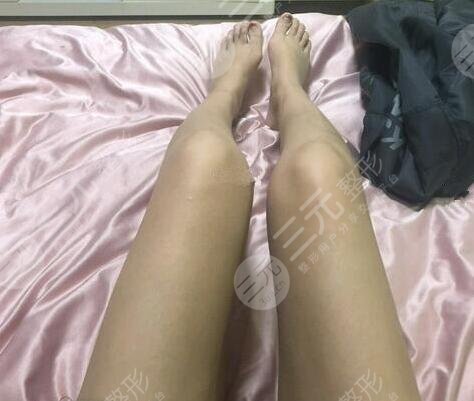 注意事项