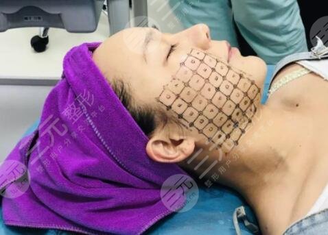 热玛吉的治疗过程