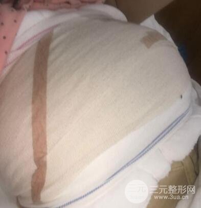 徐州四院整形美容科案例介绍