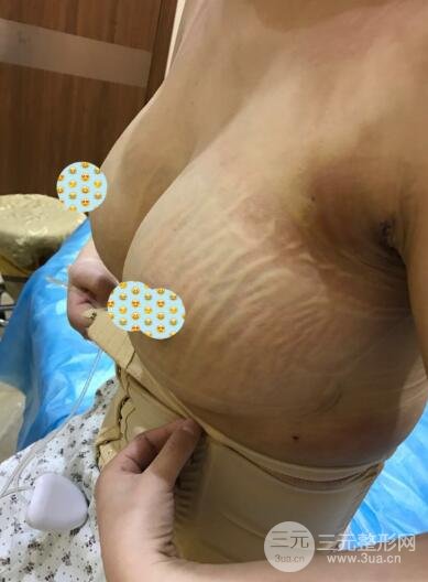 徐州四院整形美容科案例介绍