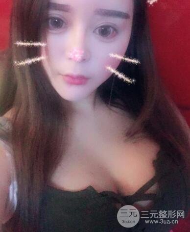 徐州四院整形美容科案例介绍