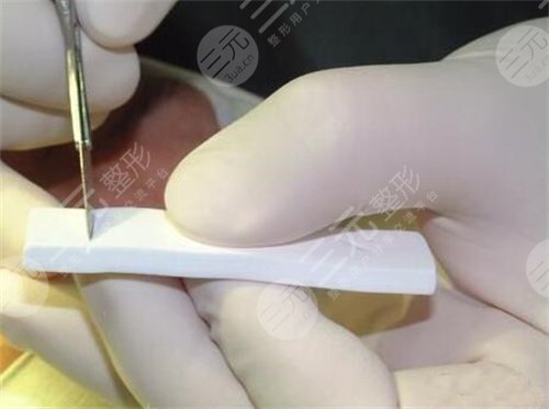 山东大学齐鲁医院整形科隆鼻术前