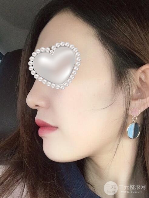 牙齿矫正案例