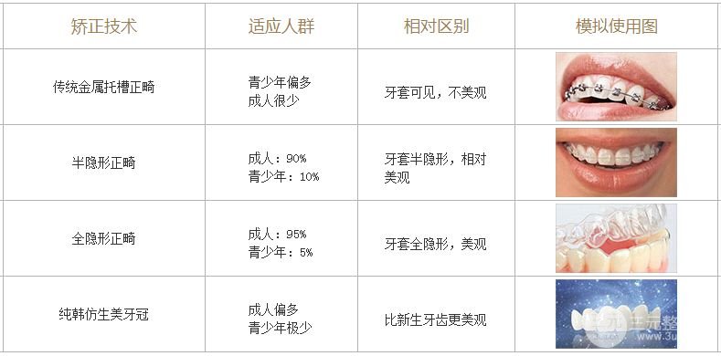 牙齿矫正科普