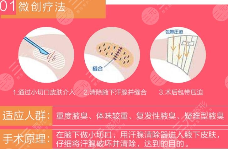 腋臭治疗手术方法