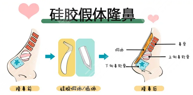 洛阳三院整形美容怎么样?让你拥有翘挺的鼻子!