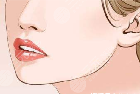 北京八大处改脸型后果