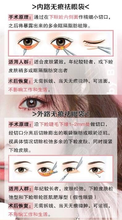 省立医院薛峰去眼袋价格是多少？