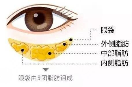 省立医院薛峰去眼袋价格是多少？