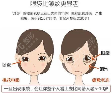 省立医院薛峰去眼袋价格是多少？