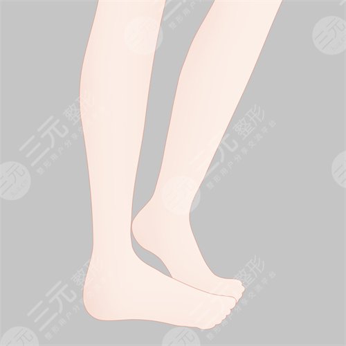 深圳人民医院腿部抽脂术后三个月
