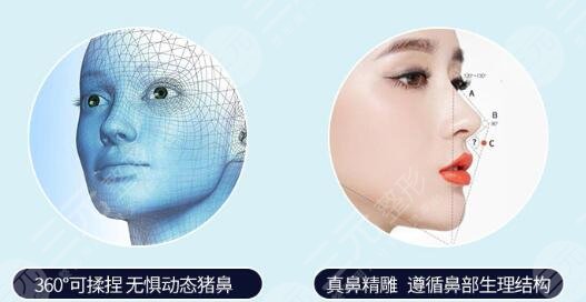 做鼻子整形的价格是多少