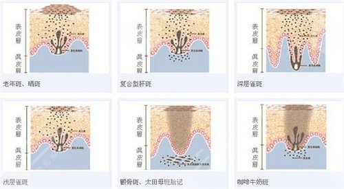 东莞康华医院皮肤科收费情况