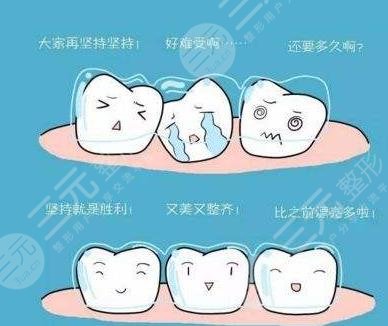 天津口腔医院牙齿矫正成功经历