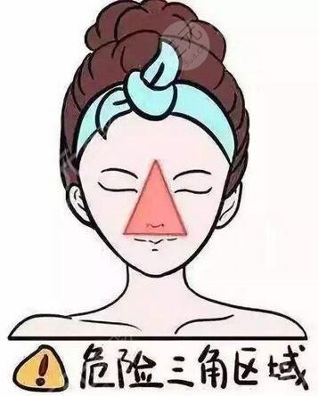 上海九院美容整形科激光祛痘案例：手术之前