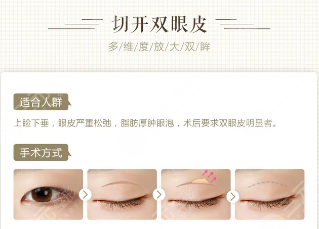 北部战区总医院整形外科好吗？附：崭新价格表|双眼皮案例