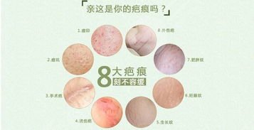 南京皮肤研究所激光祛疤案例