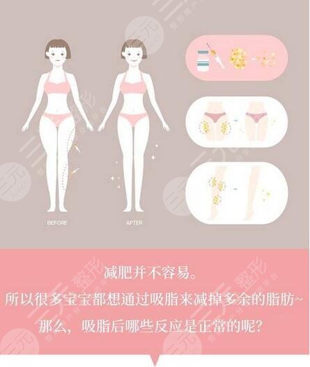 苏州市立医院腹部抽脂案例