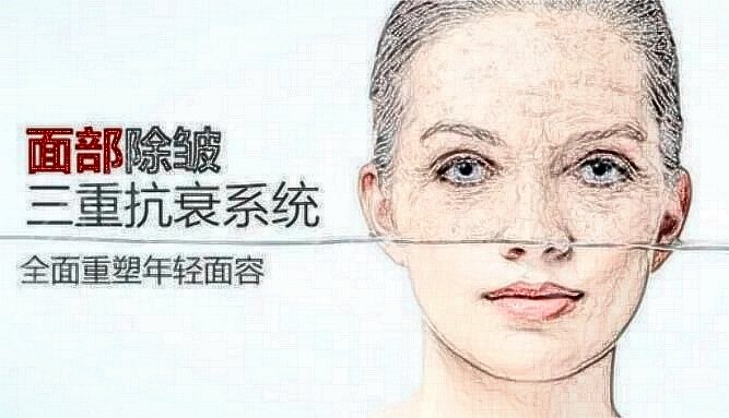 中南大学湘雅二医院整形科激光除皱案例：术前