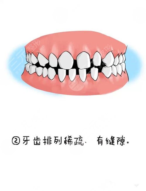 第四军医大学口腔医院牙齿矫正案例：一年后