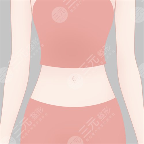 上海九院吸脂案例反馈前
