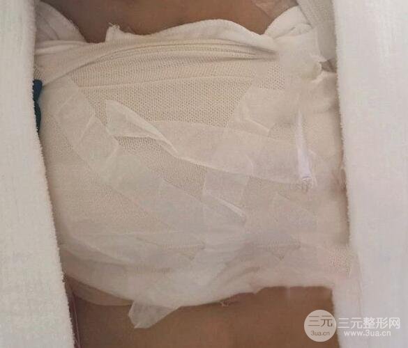 九院隆胸案例