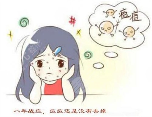 湘雅医院激光科祛痘案例后