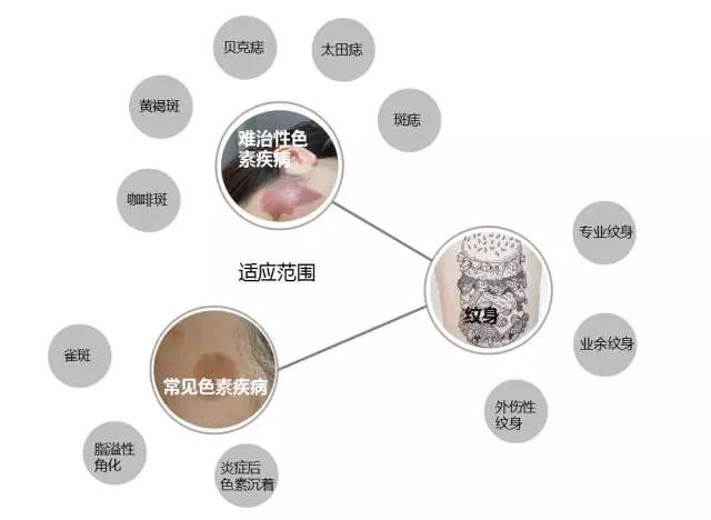许昌市中心医院整形科激光整形