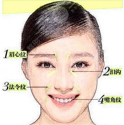 南京jur整形医院失败修复案例图