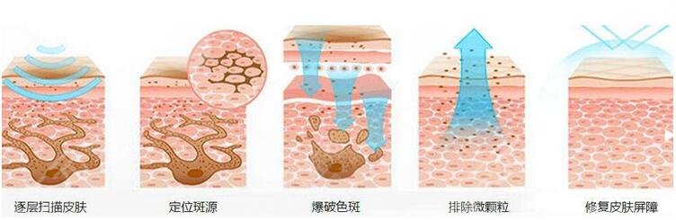 中部战区总医院整形美容科激光祛斑多少钱