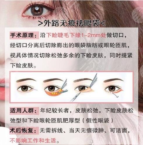 长沙湘雅医院割眼袋案例,10年熬出来的眼袋这样消灭它…