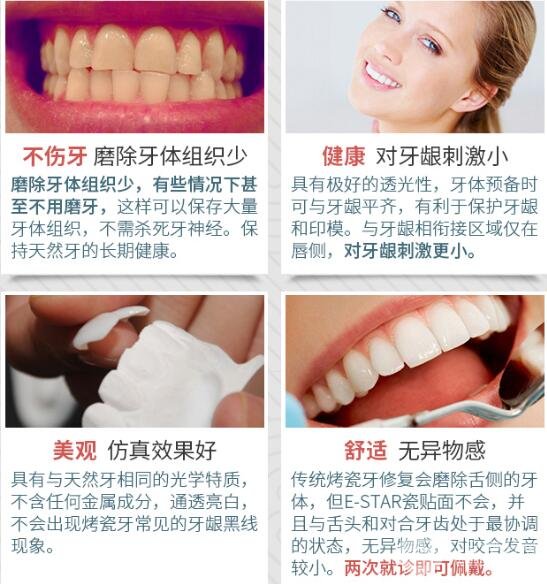 上海同口名雅口腔讲解牙齿美白