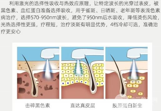湘雅附三皮肤科讲解激光除皱