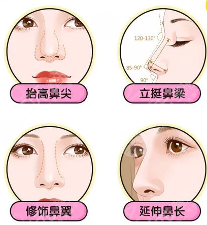 隆鼻术后对比图