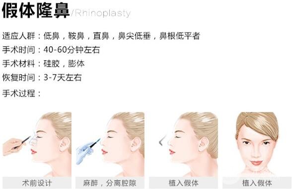 隆鼻手术讲解