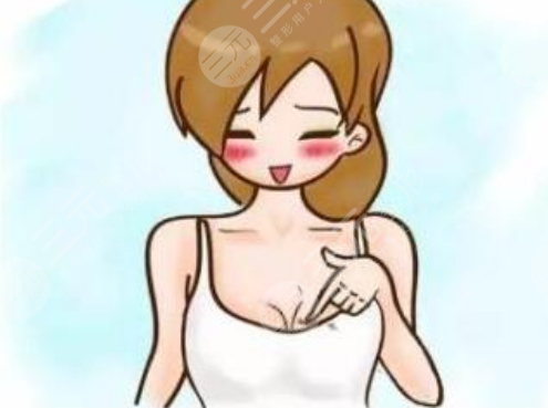 假体隆胸案例果