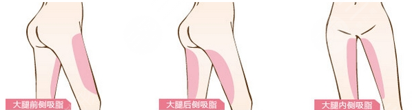 身材塑形案例