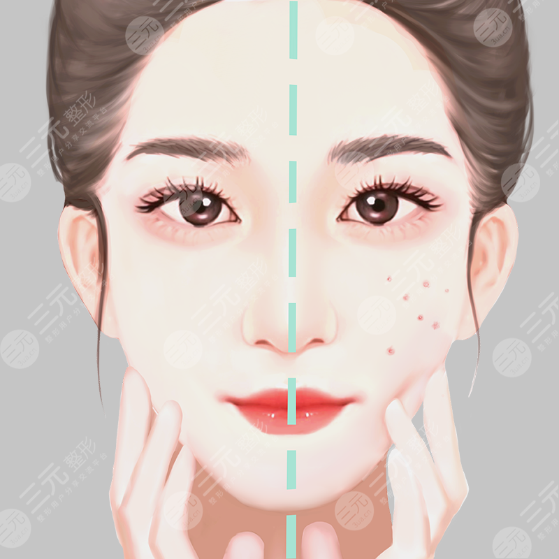 空总激光美容科光子嫩肤价格