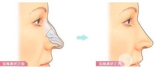 擅长项目